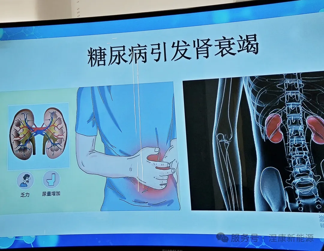 涅康新能源